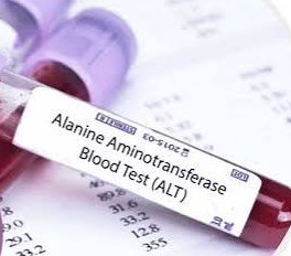Alanine Transaminase
